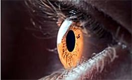 Ojo humano