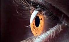 Ojo humano